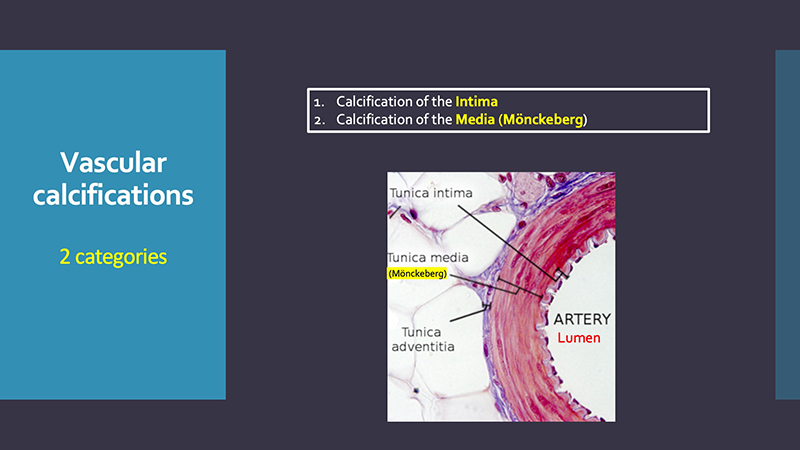 This Just In... - Radiographic Evaluation of Vascular Disease